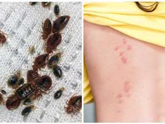 شركة مكافحة حشرات وبق الفراش في الحيل